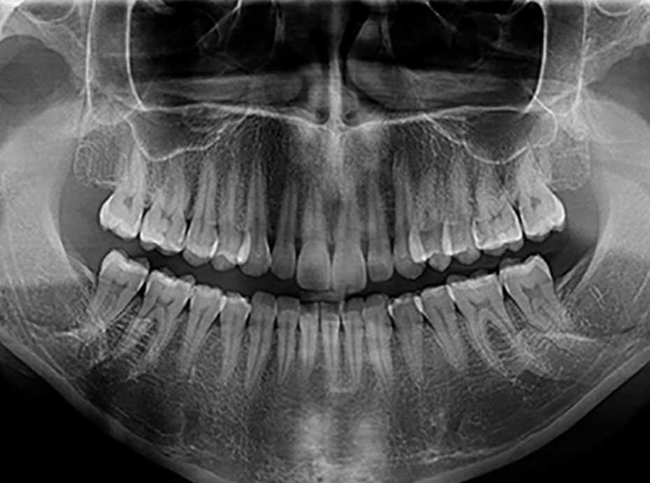 Radiografia panorâmica digital